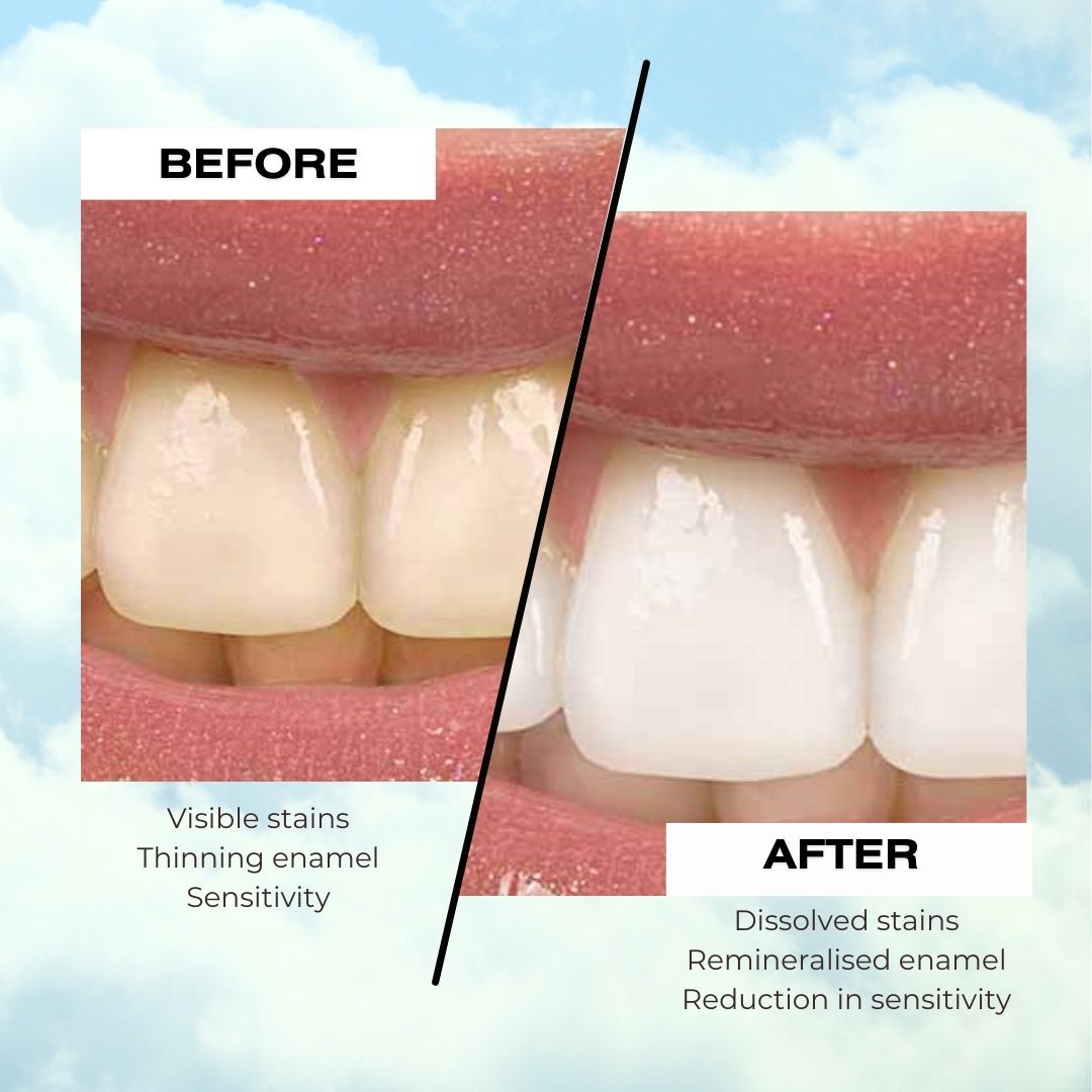 Sensitivity-Friendly Formula with Enamel Protection